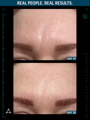 SMOOTH + FIRM EYES DUO
