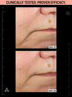 allies of skin moisturisers with peptides before after