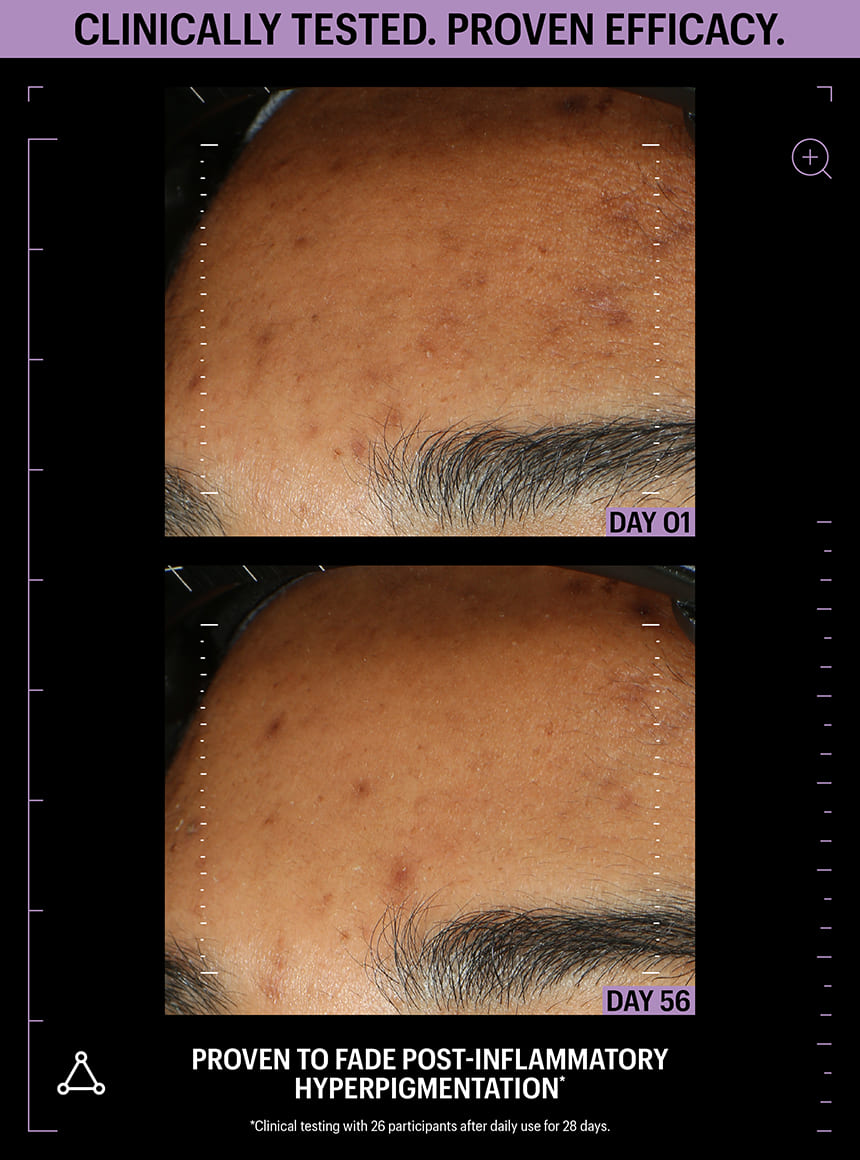 clarifying face serum before after