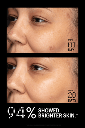 Azelaic & Kojic Advanced Clarifying Serum