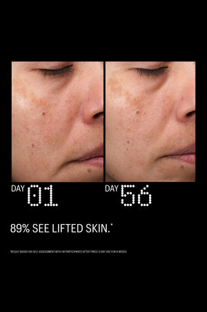 Multi Peptides & GF (Growth Factor) Advanced Lifting Serum, 15ml