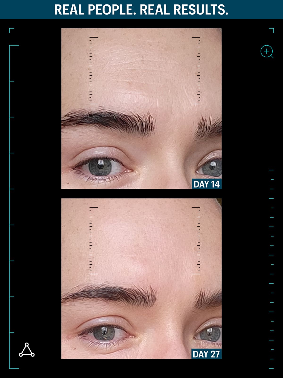 Multi GF Serum before after