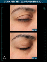 allies of skin peptides and growth factor before after