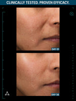Allies skin peptide before after