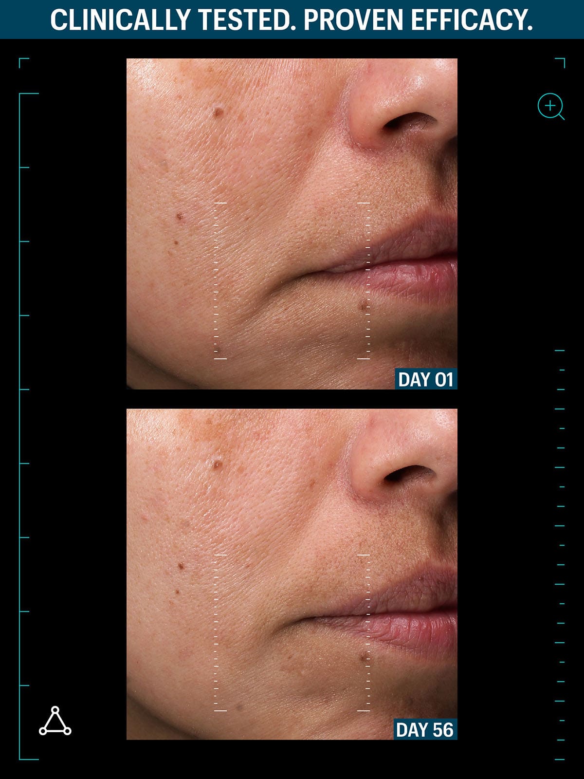 Multi growth factor serum before after