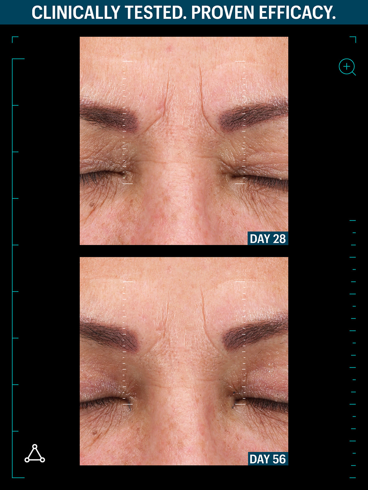 Multi peptide advanced serum before after