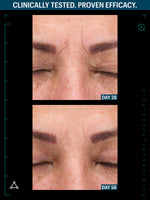 Multi peptide advanced serum before after